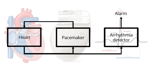 Figure 2: Pacemaker with an Arrhythmia detector.