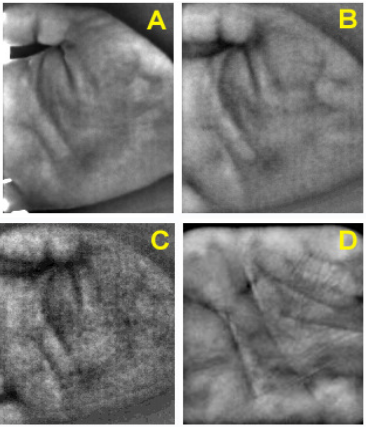 Fig. 3. (A, B, & C) Sample images from scanner 1 illuminated with 850nm IR along with ambient light leaking in through the edges