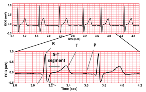 Fig.7 ECG signal waveform