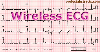 Wireless ECG